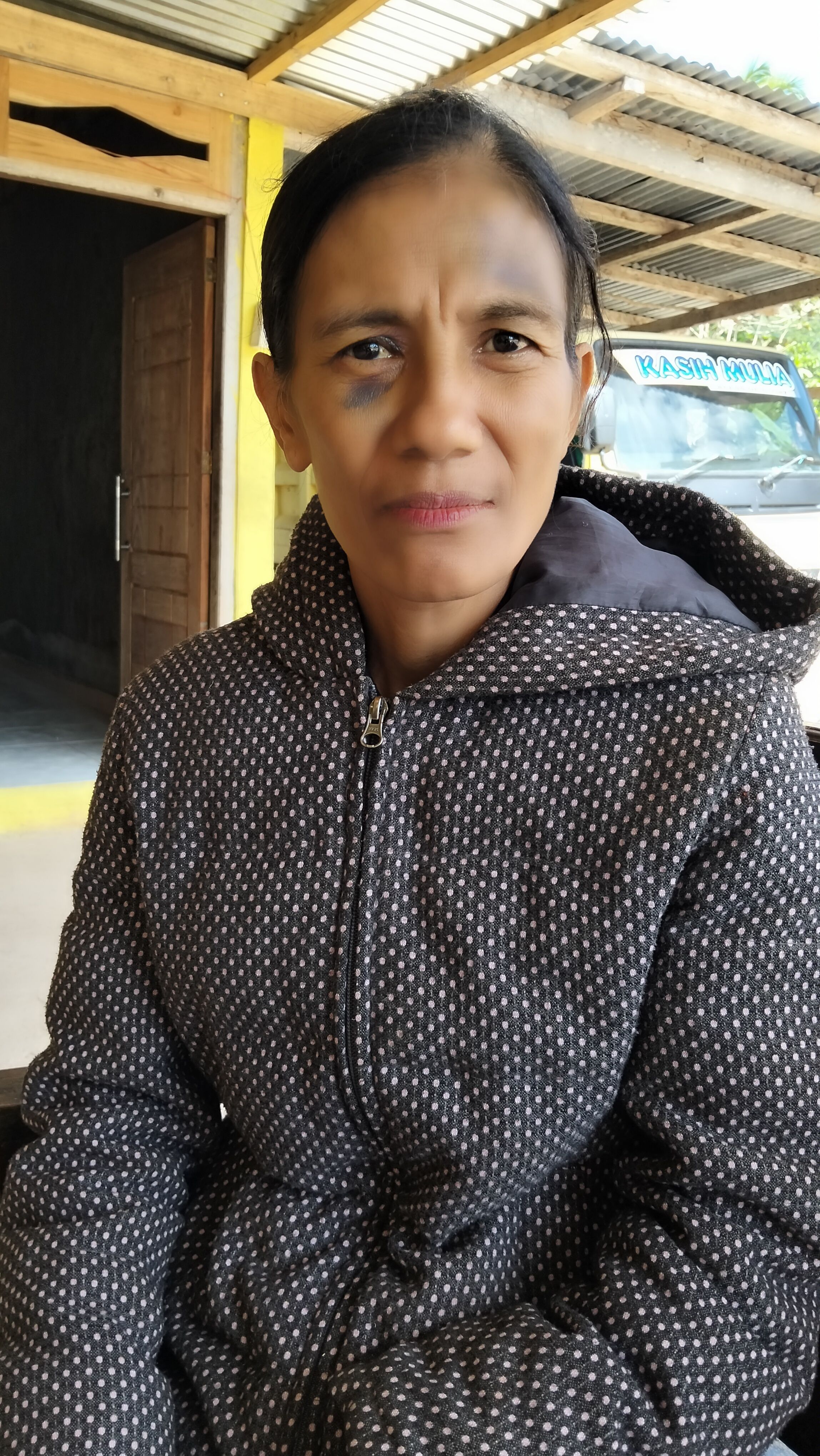 Kuat Dugaan Pelaku Berinisial AB merencanakan Penganiayaan Berat terhadap Lusia Banunaek